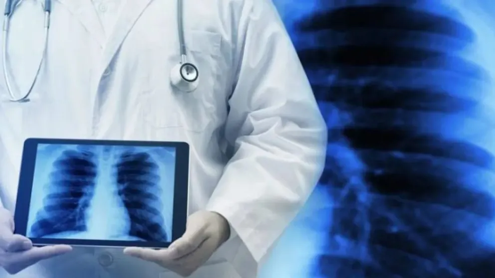 ANMAT aprobó un novedoso comprimido para tratar la hipertensión pulmonar
