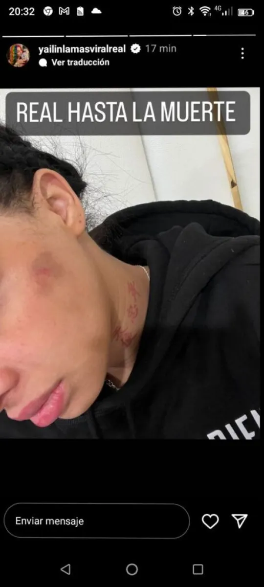 yailin golpeada