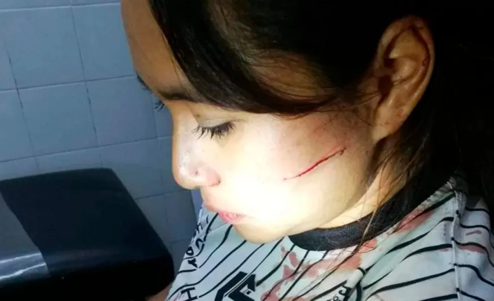 Violencia de género: golpeó e intentó asesinar a su expareja, pero fue liberado 