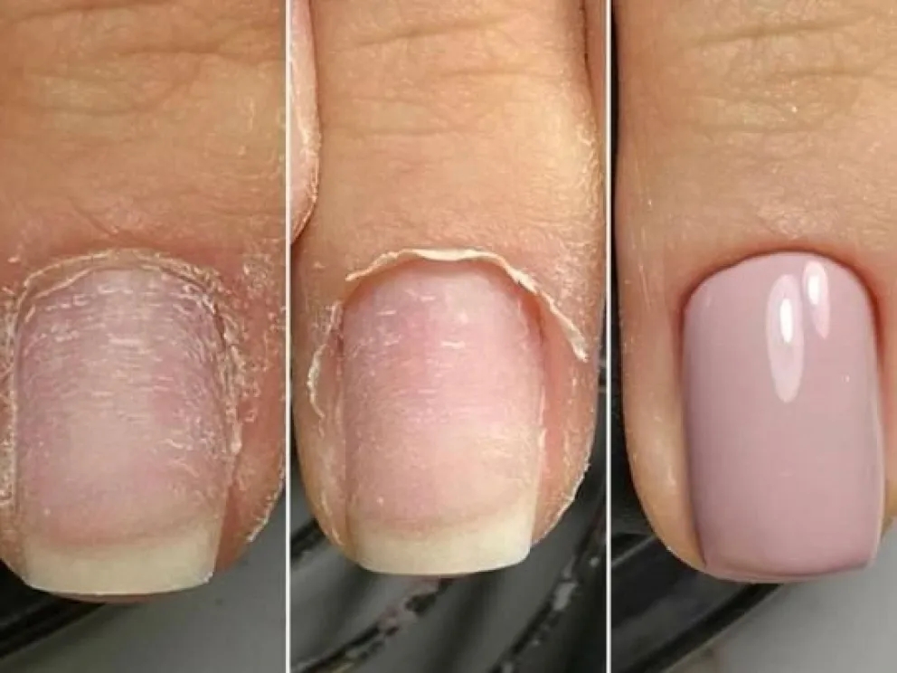 Nail art: el verdadero motivo por el que los especialistas no recomiendan la manicura “rusa”