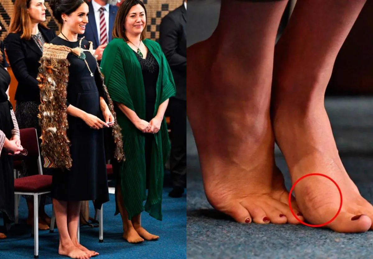 MEGHAN MARKLE