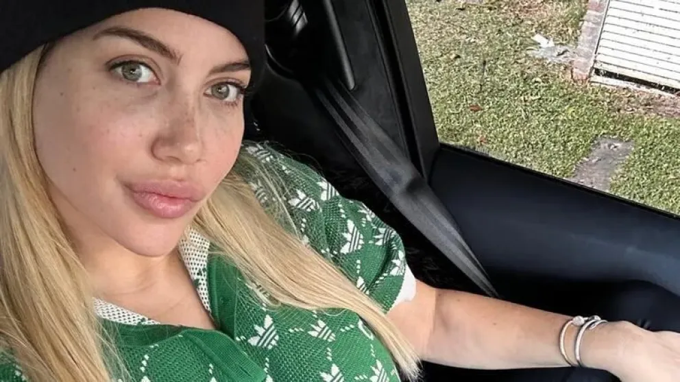 Las impresionantes lesiones que Wanda Nara mostró en sus redes: sus fans preocupados