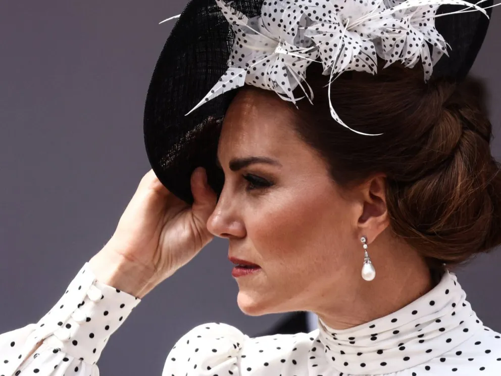 Kate Middleton sufrió humillaciones por este complejo que afectó su niñez