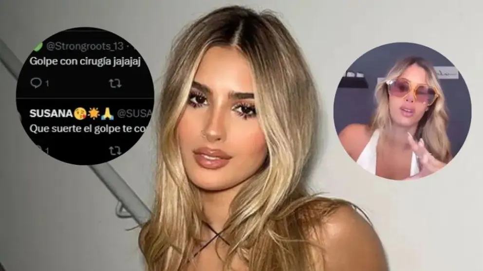 El detalle del feroz accidente que sufrió Julieta Poggio, que despertó gran polémica: video