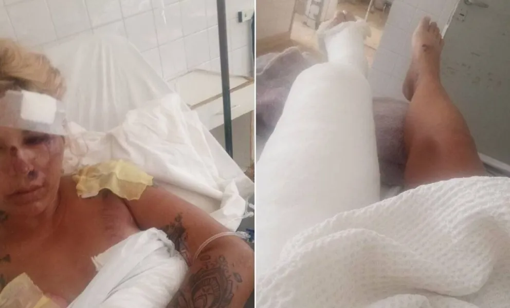 Tragedia en Avenida Paraguay: una de las internadas mostró cada una de sus heridas