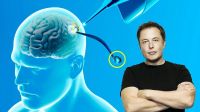Video viral de Elon Musk: conocé el primer ser humano implantado con el chip de Neurolink 