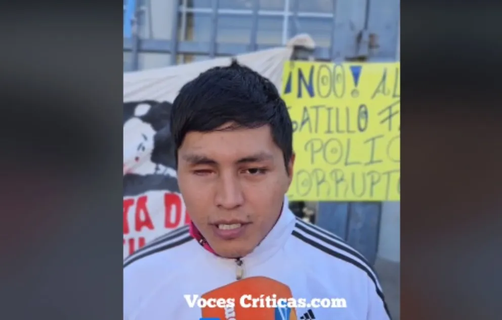 Joven salteño sin el ojo, víctima de los policías absueltos: "Me tenía apuntando y me disparó a la cara a quemarropa”