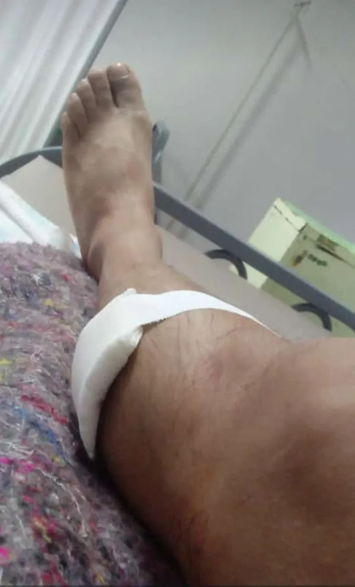 Hombre Herido tras al asalto