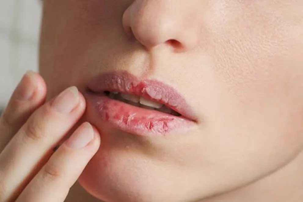labios agrietados-truco