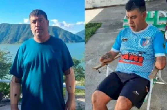 Le roban las protesis a un salte&ntilde;o