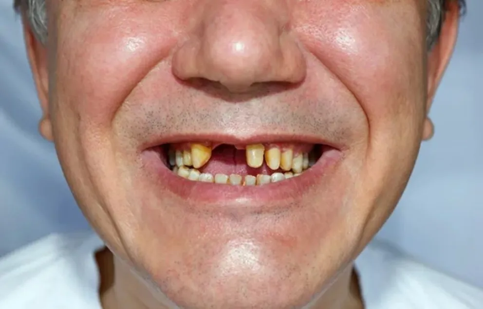 regenerar dientes