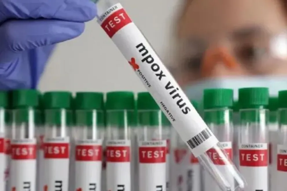 Emergencia sanitaria: confirman el primer caso autóctono de viruela del mono en el país