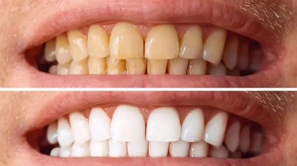 sarro dental - truco