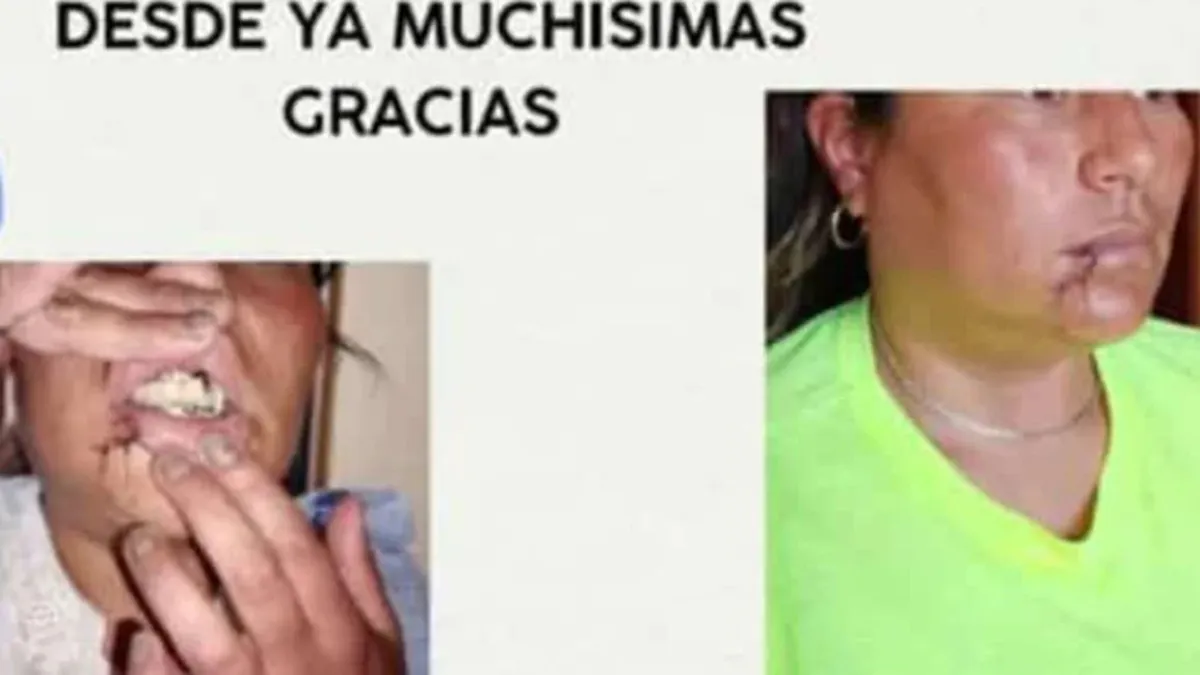 Mujer desfigurada El Quebrachal