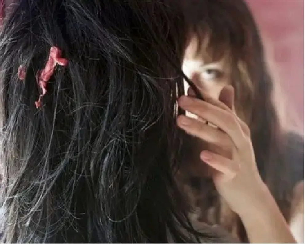 chicle pegado en el cabello - truco