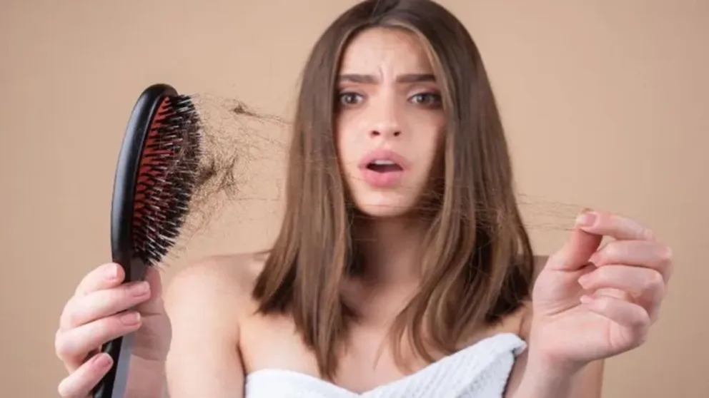 Descubrí las causas ocultas de la alopecia y cómo prevenirla: esto dicen los especialistas
