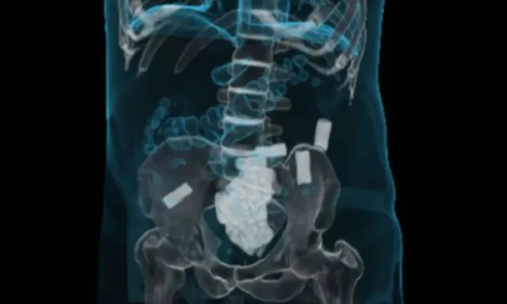 Iban de Orán a Buenos Aires: cuatro mulas fueron atrapadas con paquetes de droga en su abdomen