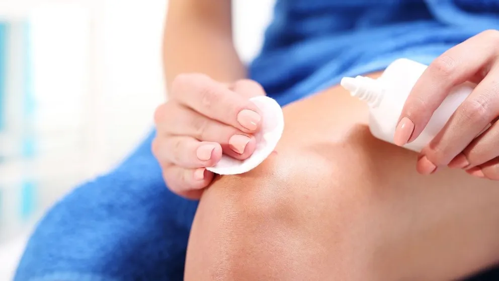 Estos son los errores más comunes al desinfectar heridas: el riesgo oculto del alcohol y el agua oxigenada 