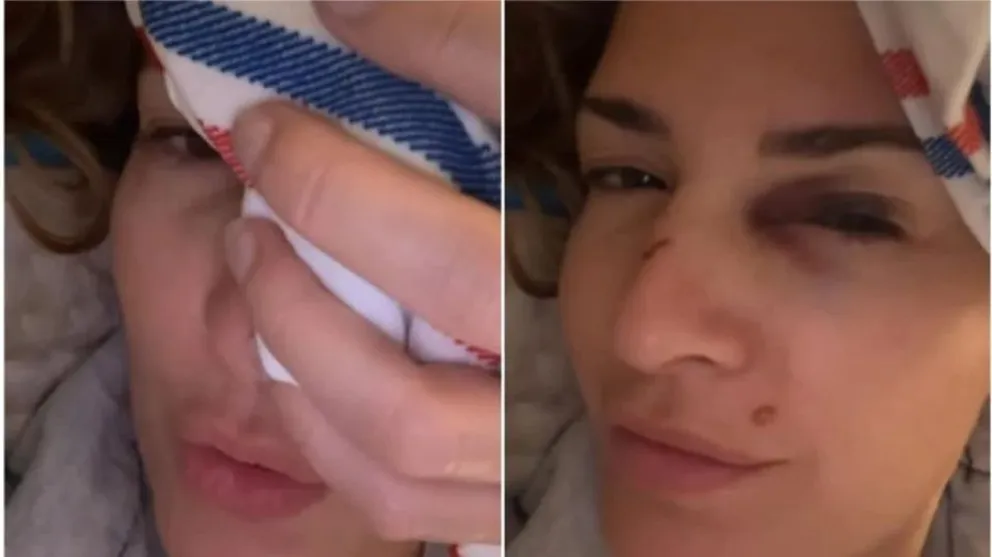 Isabel Macedo - accidente
