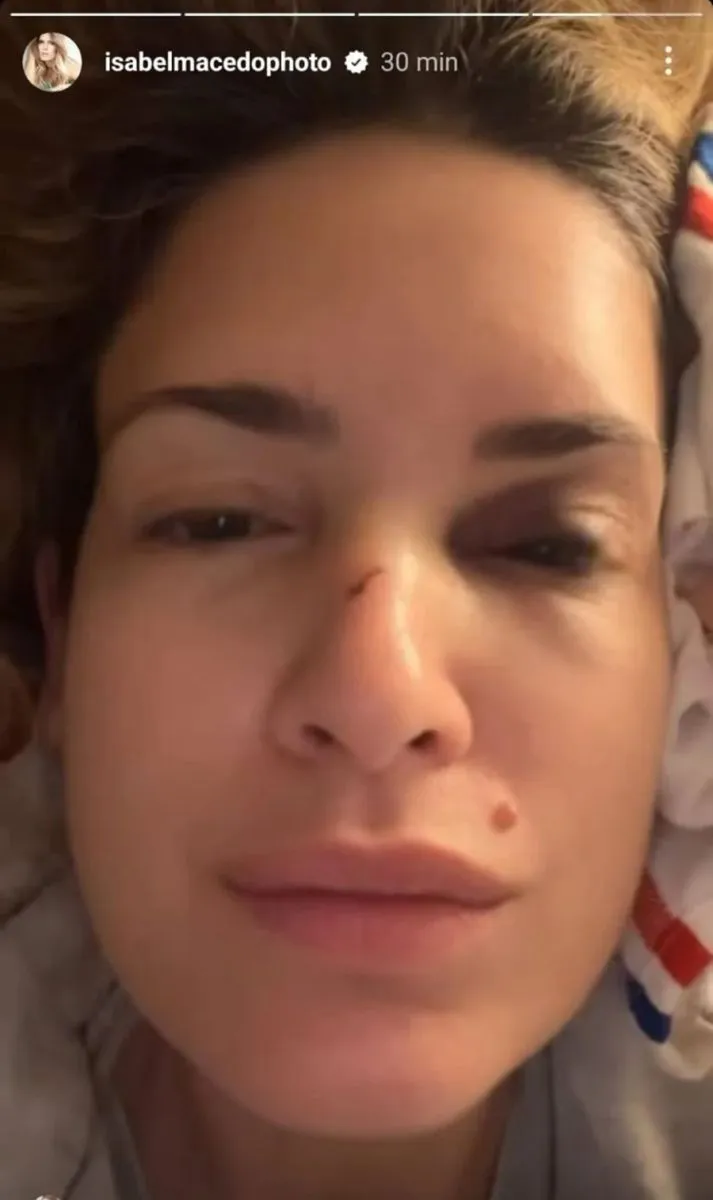 Isabel Macedo - accidente