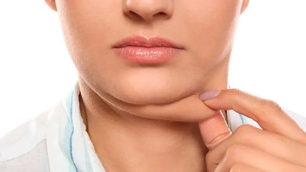 Decile adiós a la papada: conocé esta vitamina clave para reducirla de forma natural