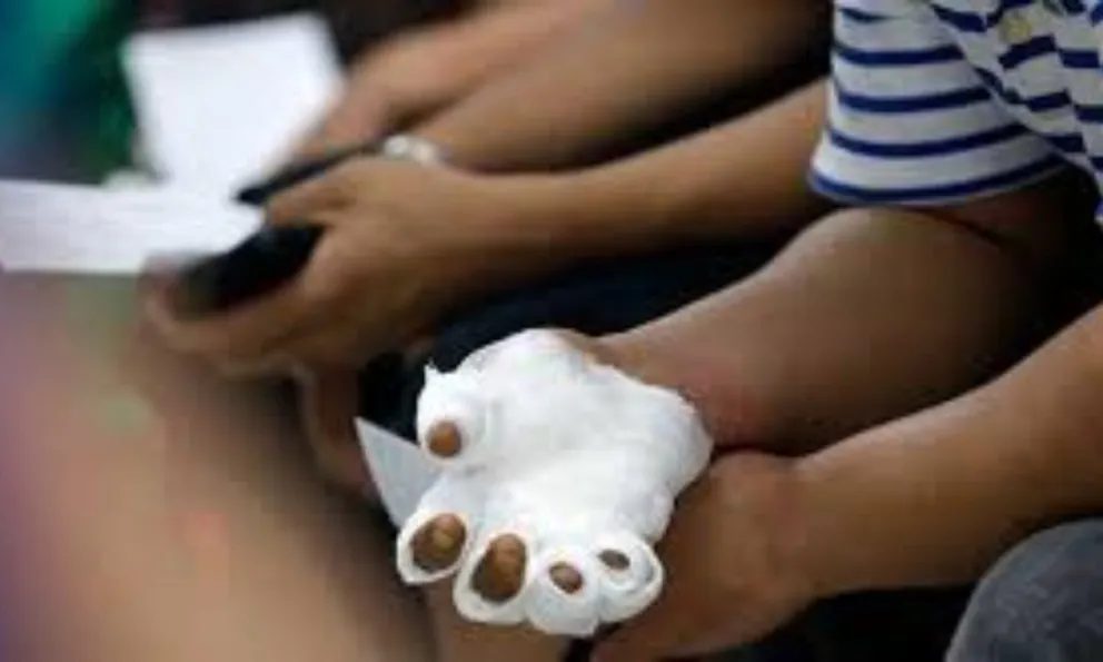 El Hospital Materno Infantil atendió a niños con quemaduras por pirotecnia