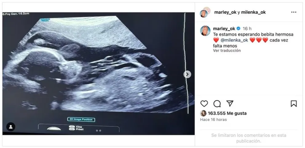Marley - hija