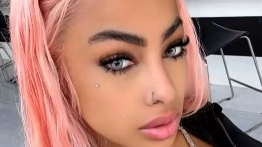 Yailin La Más Viral se arrepiente y vuelve a operarse los ojos