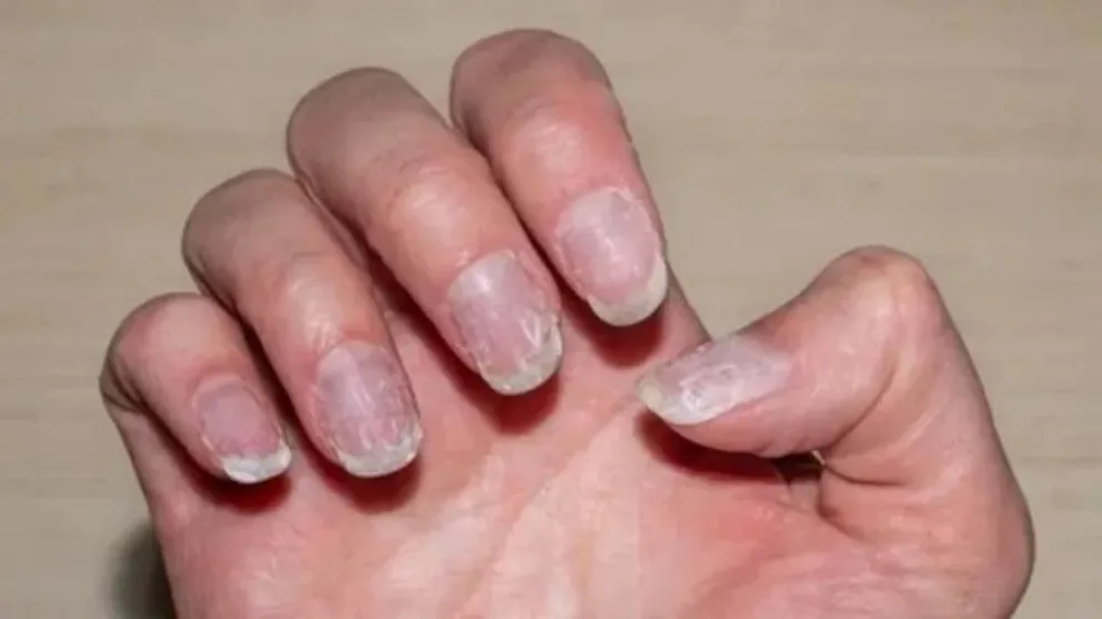 Nail Art- u&ntilde;as