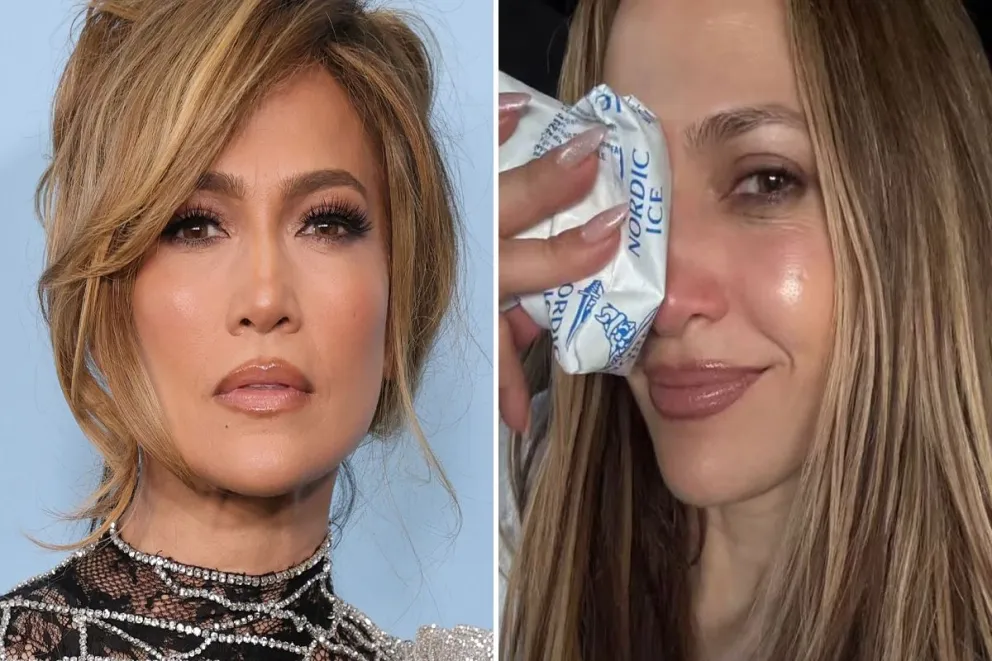 Jennifer López impacta tras aparatosa caída: su nariz quedó gravemente golpeada en ensayos AMAs