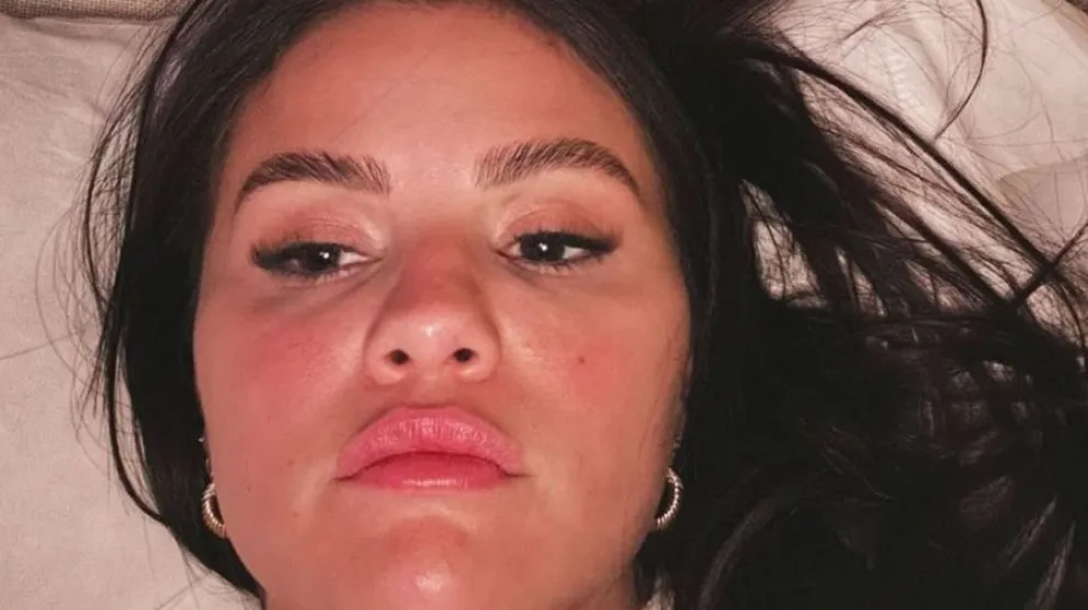 Selena G&oacute;mez - enfermedad