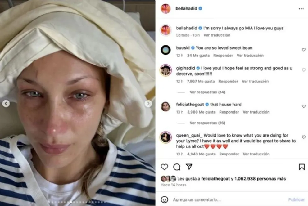 Bella Hadid - enfermedad