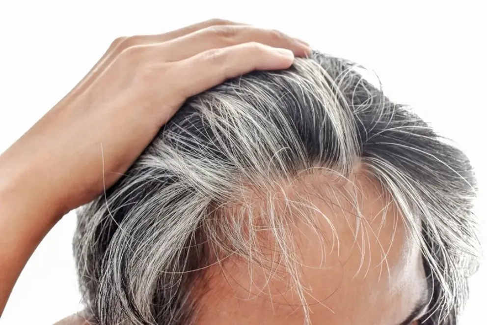 El truco para atenuar la canas sin da&ntilde;ar el cabello