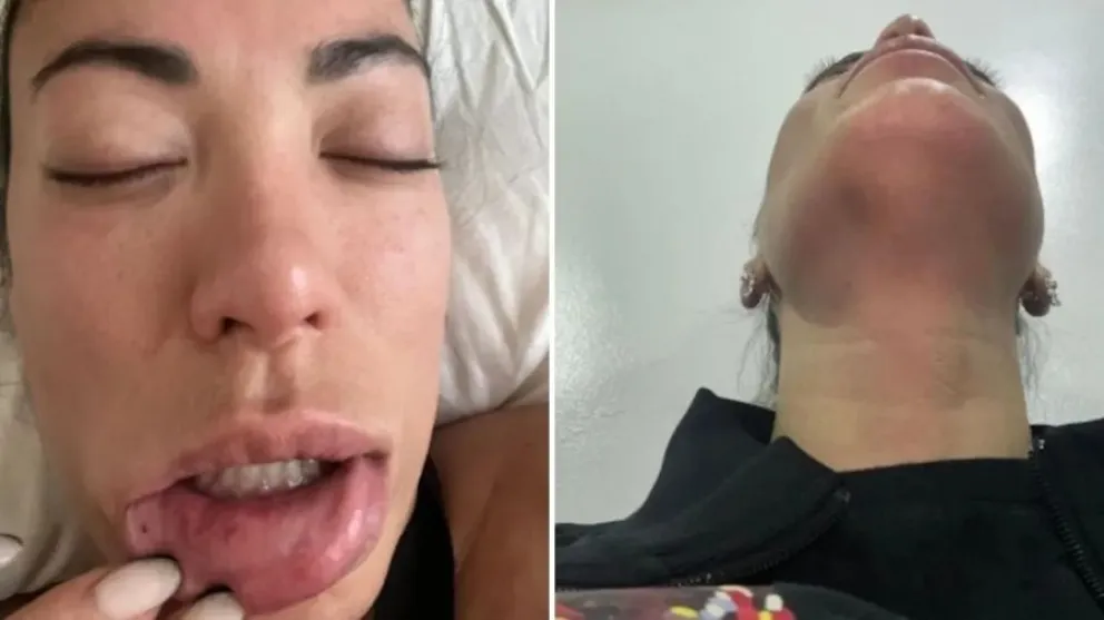 Pamela Pombo cont&oacute; su situaci&oacute;n de violencia por parte de expareja