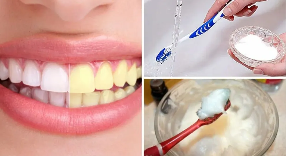 El truco para blanquear los dientes con bicarbonato